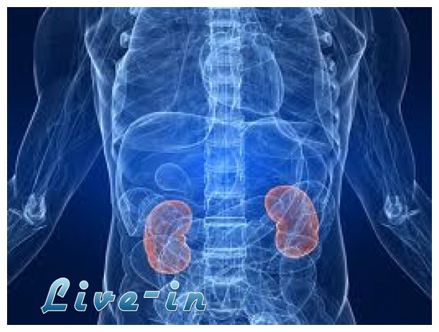 Î— ÏƒÏ‰ÏƒÏ„Î® Î´Î¹Î±Ï„ÏÎ¿Ï†Î® Î³Î¹Î± Ï„Î¹Ï‚ Ï€Î±Î¸Î®ÏƒÎµÎ¹Ï‚ Ï„Ï‰Î½ Î½ÎµÏ†ÏÏŽÎ½live-in | Η Έξυπνη, Αντικειμενική και Εναλλακτική Ενημέρωση!