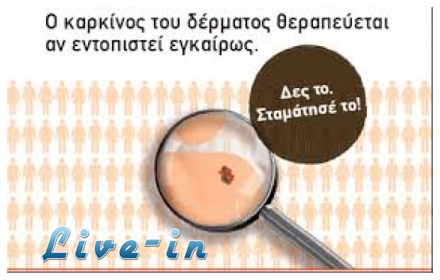 Î•Î»Î»Î·Î½Î¹ÎºÎ® Î•Î²Î´Î¿Î¼Î¬Î´Î± ÎºÎ±Ï„Î¬ Ï„Î¿Ï… ÎºÎ±ÏÎºÎ¯Î½Î¿Ï… Ï„Î¿Ï… Î´Î­ÏÎ¼Î±Ï„Î¿Ï‚!live-in | Η Έξυπνη, Αντικειμενική και Εναλλακτική Ενημέρωση!