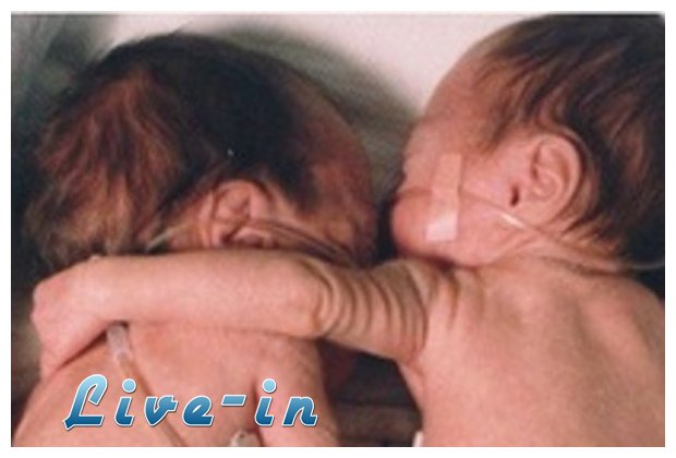 ÎÎµÎ¿Î³Î­Î½Î½Î·Ï„Î± Î±Î³ÎºÎ±Î»Î¹Î¬Î¶Î¿Î½Ï„Î±Î¹ Î³Î¹Î± Î½Î± ÎµÏ€Î¹Î²Î¹ÏŽÏƒÎ¿Ï…Î½live-in | Η Έξυπνη, Αντικειμενική και Εναλλακτική Ενημέρωση!