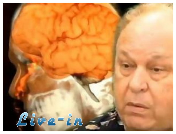Â«ÎˆÏ„ÏÎµÏ‡ÎµÂ» Î¿ ÎµÎ³ÎºÎ­Ï†Î±Î»Î¿Ï‚ Î±Ï€ÏŒ Ï„Î·â€¦ Î¼ÏÏ„Î· Ï„Î¿Ï…!live-in | Η Έξυπνη, Αντικειμενική και Εναλλακτική Ενημέρωση!