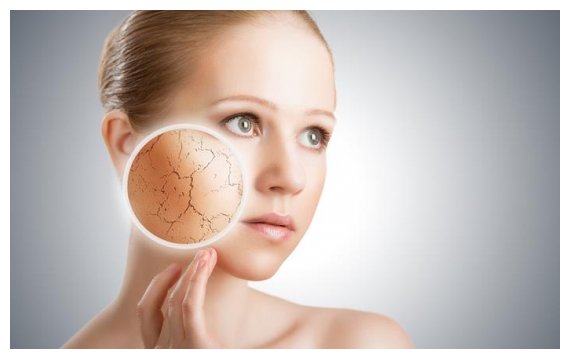 7 ÏƒÏ…Î½Î®Î¸ÎµÎ¹ÎµÏ‚ Ï€Î¿Ï… ÎºÎ¬Î½Î¿Ï…Î½ Ï„Î¿ Î´Î­ÏÎ¼Î± ÏƒÎ¿Ï… Î½Î± Î³ÎµÏÎ½Î¬ÎµÎ¹ Ï€Î¹Î¿ Î³ÏÎ®Î³Î¿ÏÎ±live-in | Η Έξυπνη, Αντικειμενική και Εναλλακτική Ενημέρωση!