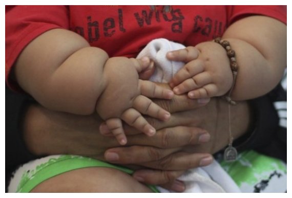 ÎœÏ‰ÏÏŒ-Î³Î¯Î³Î±Ï‚: ÎœÏŒÎ»Î¹Ï‚ 8 Î¼Î·Î½ÏŽÎ½ ÎºÎ±Î¹ ÎµÎ¯Î½Î±Î¹ 20 ÎºÎ¹Î»Î¬!live-in | Η Έξυπνη, Αντικειμενική και Εναλλακτική Ενημέρωση!