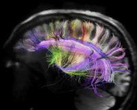 Î Î±ÏÎ¬Î¾ÎµÎ½Î± Ï†Î±Î¹Î½ÏŒÎ¼ÎµÎ½Î± Ï„Î¿Ï… Î¼Ï…Î±Î»Î¿Ï!live-in | Η Έξυπνη, Αντικειμενική και Εναλλακτική Ενημέρωση!