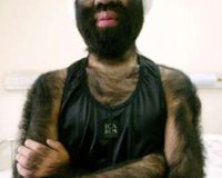 ÎŸ Ï€Î¹Î¿ Ï„ÏÎ¹Ï‡Ï‰Ï„ÏŒÏ‚ Î¬Î½Î¸ÏÏ‰Ï€Î¿Ï‚ ÏƒÏ„Î¿Î½ ÎºÏŒÏƒÎ¼Î¿!live-in | Η Έξυπνη, Αντικειμενική και Εναλλακτική Ενημέρωση!