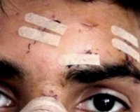 Î’Î¯Î½Ï„ÎµÎ¿ - Î¼Î±ÏÏ„Ï…ÏÎ¯Î± 14Ï‡ÏÎ¿Î½Î¿Ï… Î‘Ï†Î³Î±Î½Î¿Ï: "Î¤ÏŽÏÎ± Ï‡Ï„ÏÏ€Î·ÏƒÎ±Î½ ÎµÎ¼Î­Î½Î±. Î‘Ï‚ Î³Î¯Î½ÎµÎ¹ ÎºÎ¬Ï„Î¹ Î½Î± Î¼Î·Î½ Î¾Î±Î½Î±Ï‡Ï„Ï…Ï€Î®ÏƒÎ¿Ï…Î½ Î¬Î»Î»Î¿Ï…Ï‚"live-in | Η Έξυπνη, Αντικειμενική και Εναλλακτική Ενημέρωση!