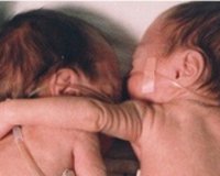 ÎÎµÎ¿Î³Î­Î½Î½Î·Ï„Î± Î±Î³ÎºÎ±Î»Î¹Î¬Î¶Î¿Î½Ï„Î±Î¹ Î³Î¹Î± Î½Î± ÎµÏ€Î¹Î²Î¹ÏŽÏƒÎ¿Ï…Î½!live-in | Η Έξυπνη, Αντικειμενική και Εναλλακτική Ενημέρωση!
