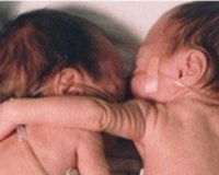 ÎÎµÎ¿Î³Î­Î½Î½Î·Ï„Î± Î±Î³ÎºÎ±Î»Î¹Î¬Î¶Î¿Î½Ï„Î±Î¹ Î³Î¹Î± Î½Î± ÎµÏ€Î¹Î²Î¹ÏŽÏƒÎ¿Ï…Î½live-in | Η Έξυπνη, Αντικειμενική και Εναλλακτική Ενημέρωση!