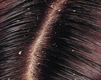 Î¦Ï…ÏƒÎ¹ÎºÎ­Ï‚ Î¸ÎµÏÎ±Ï€ÎµÎ¯ÎµÏ‚ ÎºÎ±Ï„Î¬ Ï„Î·Ï‚ Ï€Î¹Ï„Ï…ÏÎ¯Î´Î±Ï‚live-in | Η Έξυπνη, Αντικειμενική και Εναλλακτική Ενημέρωση!